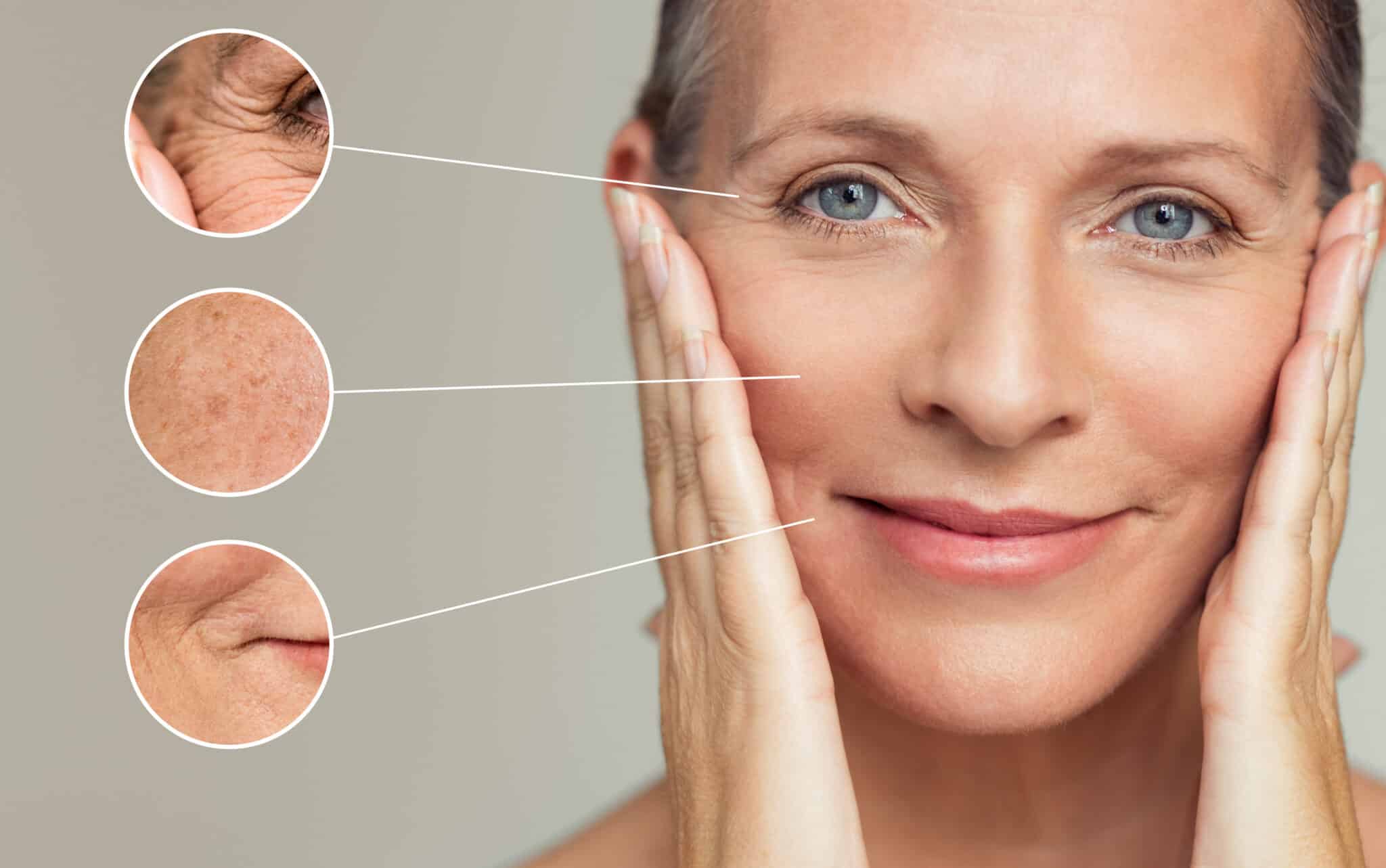 face-thread-lift-treatments-in-vancouver